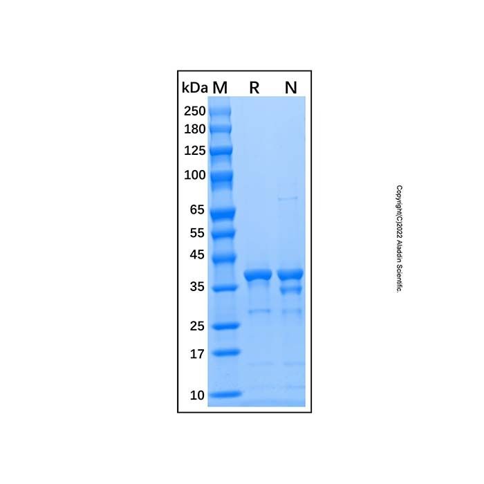Recombinant Human Arginase 1/ARG1 Protein -    by Aladdin Scientific