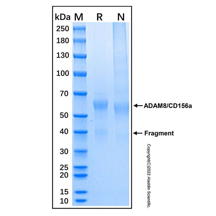Recombinant Human ADAM8/CD156a Protein -    by Aladdin Scientific