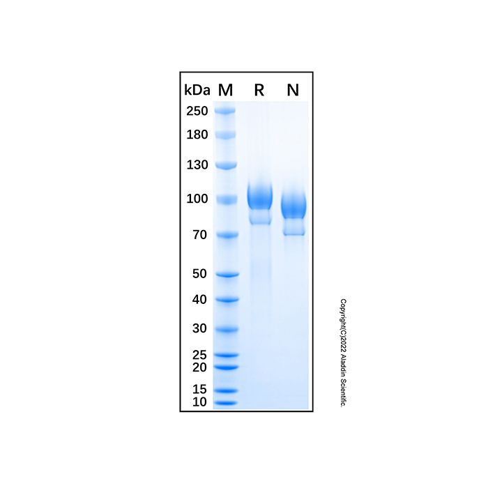 Recombinant Human OCAM/NCAM2 Protein -    by Aladdin Scientific
