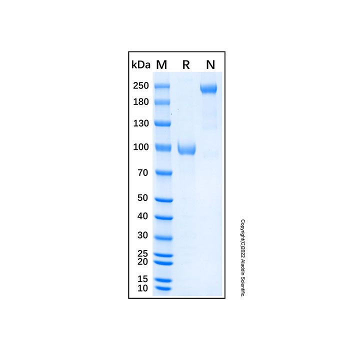 Recombinant Human Nogo Receptor Protein -    by Aladdin Scientific
