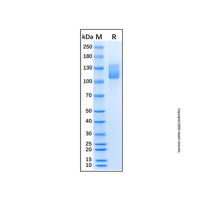 Recombinant Human OSMR beta Protein -    by Aladdin Scientific