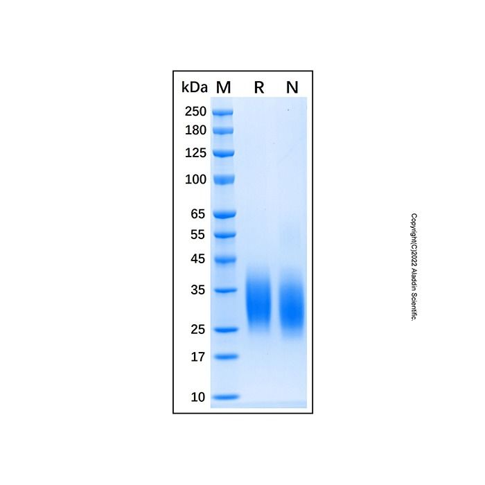 Recombinant Human PTH1R/PTHR1 Protein -    by Aladdin Scientific