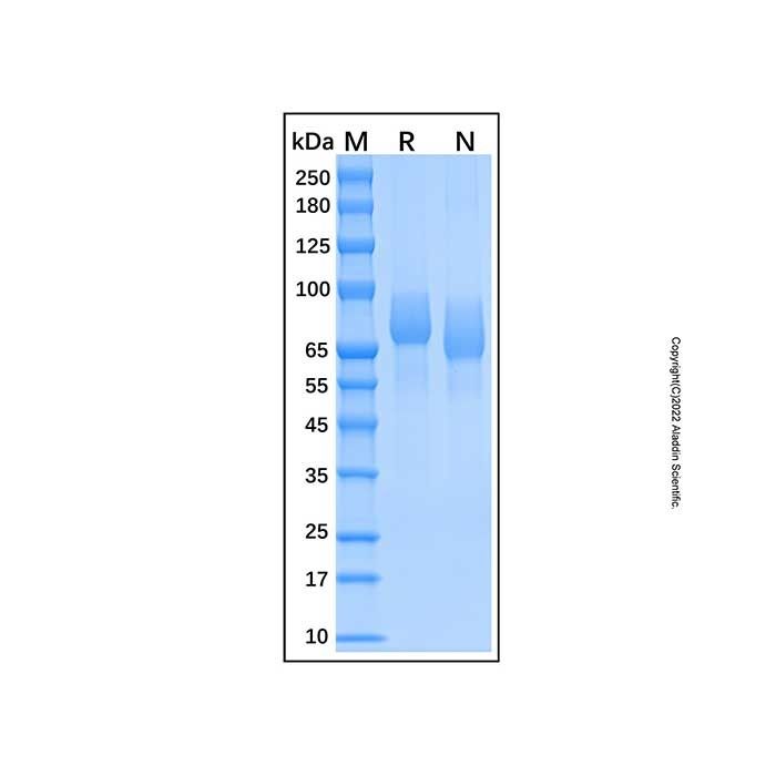 Recombinant Human PDGFR alpha Protein -    by Aladdin Scientific