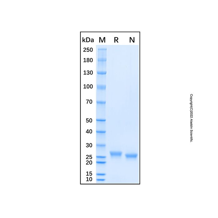 Recombinant Human Pentraxin 2/SAP Protein -    by Aladdin Scientific