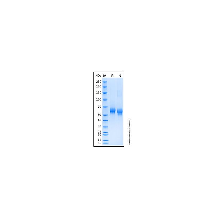 Recombinant Human SMOC-1 Protein -    by Aladdin Scientific