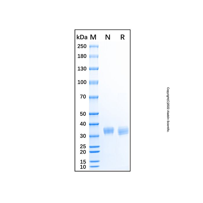 Recombinant Human TRACP/PAP/ACP5 Protein -    by Aladdin Scientific