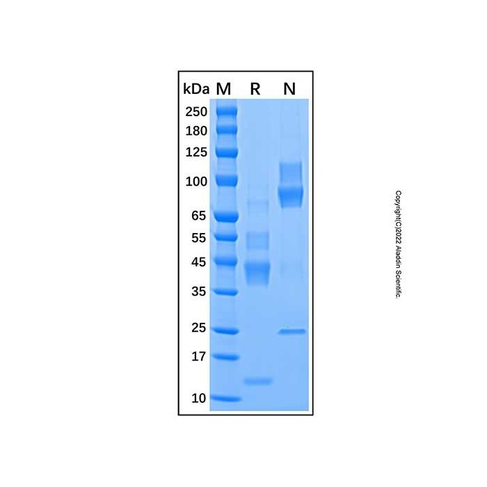 Recombinant Human TGF-beta 1 Protein -    by Aladdin Scientific
