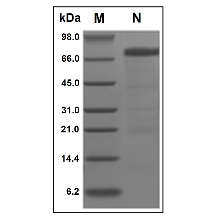 Recombinant Human HVEM/TNFRSF14 Protein -    by Aladdin Scientific
