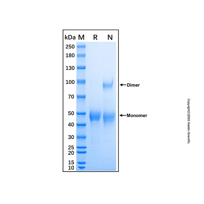 Recombinant Human TPST1 Protein -    by Aladdin Scientific