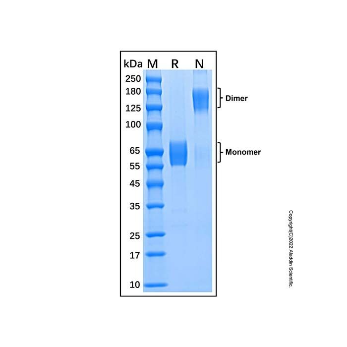 Recombinant Human TREM-1 Protein -    by Aladdin Scientific
