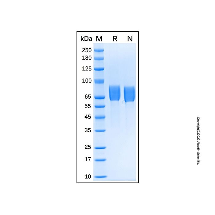 Recombinant Human Vanin-1/VNN1 Protein -    by Aladdin Scientific