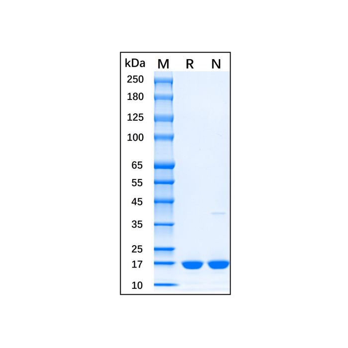 Recombinant Mouse IL-1 beta Protein -    by Aladdin Scientific