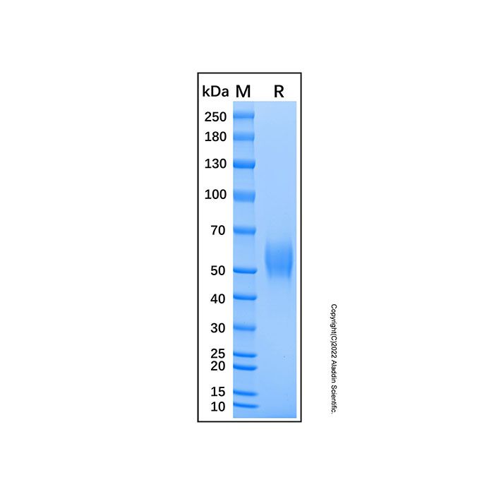 Recombinant Mouse IL-1 RI Protein -    by Aladdin Scientific