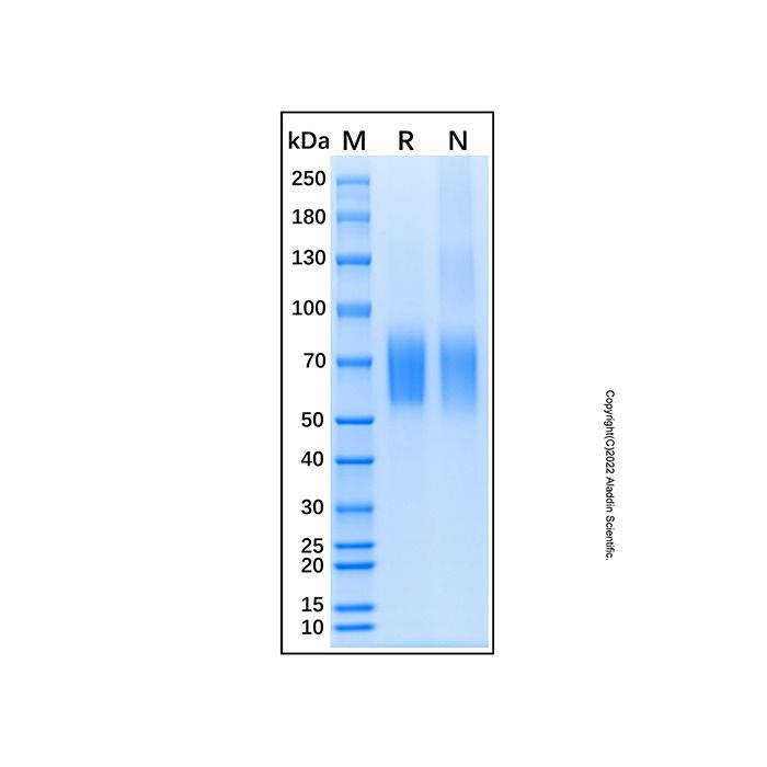 Recombinant Mouse IL-23R Protein -    by Aladdin Scientific