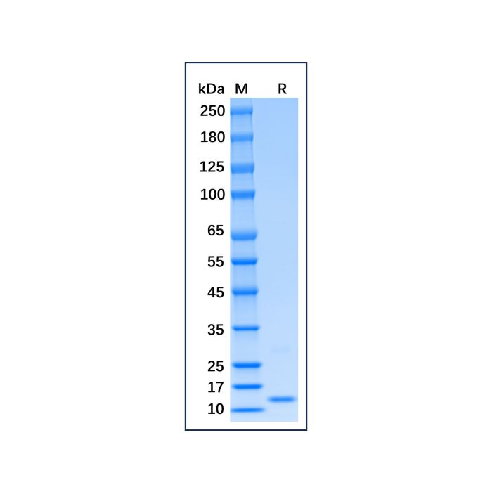 Recombinant Mouse IFN-gamma Protein -    by Aladdin Scientific