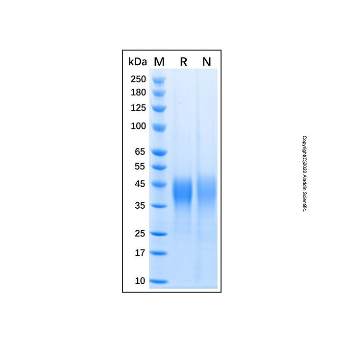 Recombinant Mouse LIF Protein -    by Aladdin Scientific
