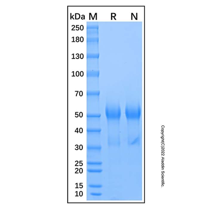 Recombinant Mouse Osteopontin/OPN Protein -    by Aladdin Scientific