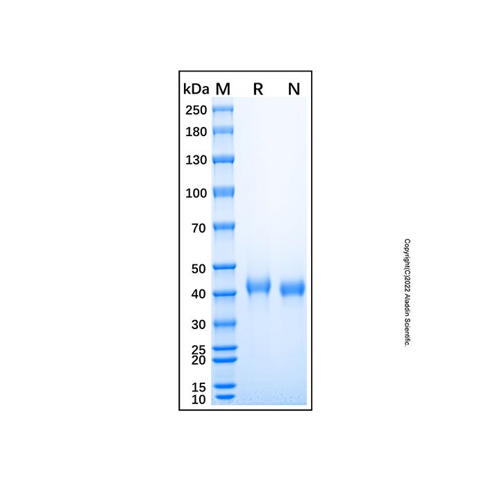Recombinant Mouse RSPO1 Protein -    by Aladdin Scientific
