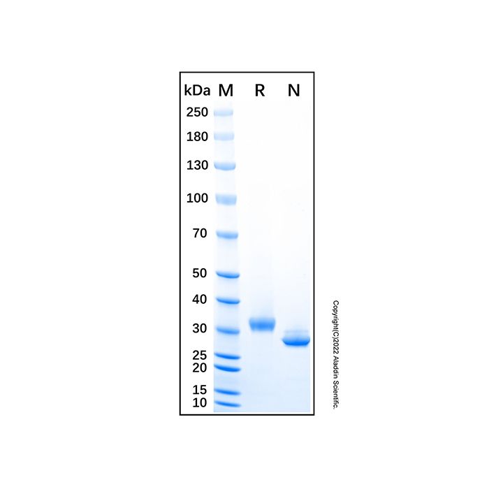 Recombinant Mouse sFRP-2 Protein -    by Aladdin Scientific