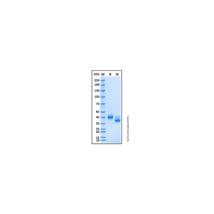 Recombinant Mouse SPARC Protein -    by Aladdin Scientific