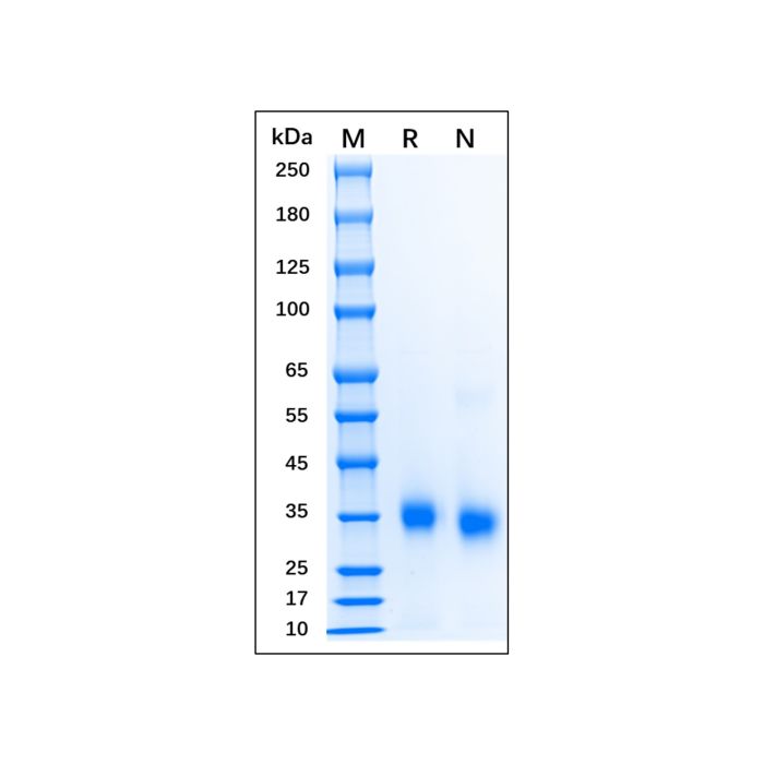 Recombinant Human SARS-CoV-2 Spike Protein RBD -    by Aladdin Scientific