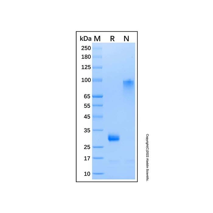 Recombinant Human Noggin Protein -    by Aladdin Scientific