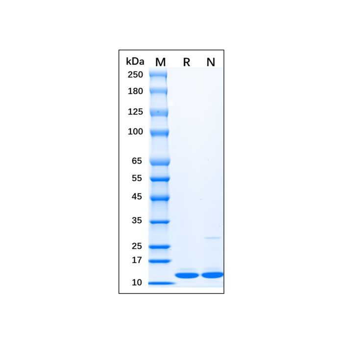 Recombinant Human Doublecortin Protein -    by Aladdin Scientific