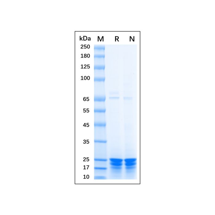 Recombinant Human TAGLN/Transgelin Protein -    by Aladdin Scientific