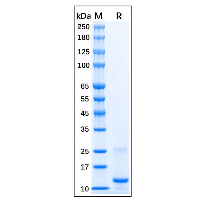 Recombinant Human CTGF Protein -    by Aladdin Scientific