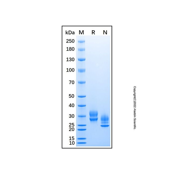 Recombinant Mouse Kallikrein 7 Protein -    by Aladdin Scientific