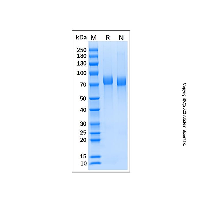 Recombinant Human IL-6/IL-6R alpha Protein -    by Aladdin Scientific