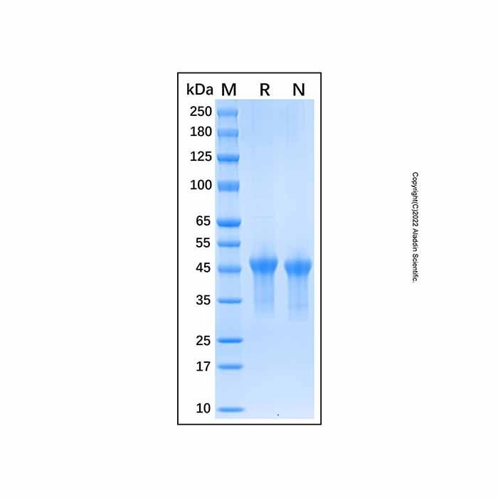 Recombinant Human VSIG4 Protein -    by Aladdin Scientific