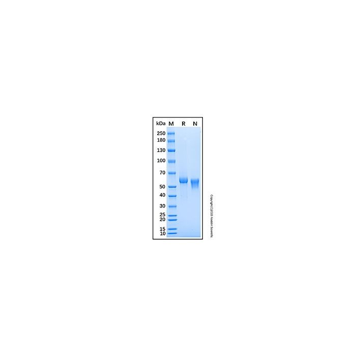 Recombinant Rat DLL1 Protein -    by Aladdin Scientific
