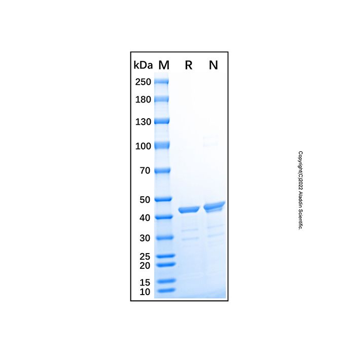 Recombinant Human Creatine Kinase MM/CKMM Protein -    by Aladdin Scientific