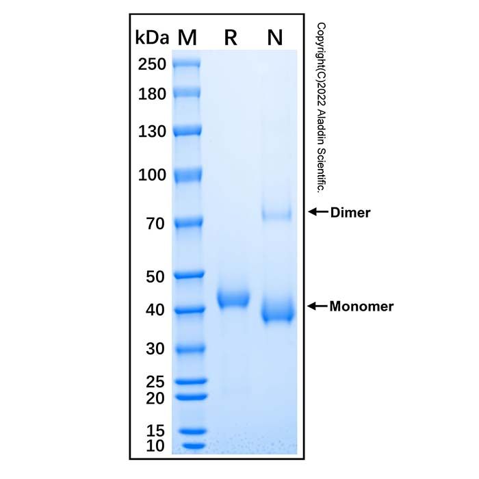 Recombinant Human Cathepsin H Protein -    by Aladdin Scientific