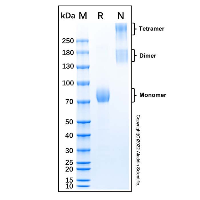 Recombinant Human IL-17RB Protein -    by Aladdin Scientific