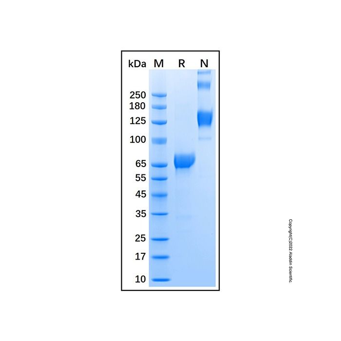 Recombinant Human Hip Protein -    by Aladdin Scientific
