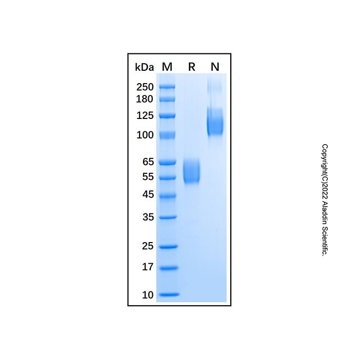 Recombinant Mouse Activin RIIB Protein -    by Aladdin Scientific