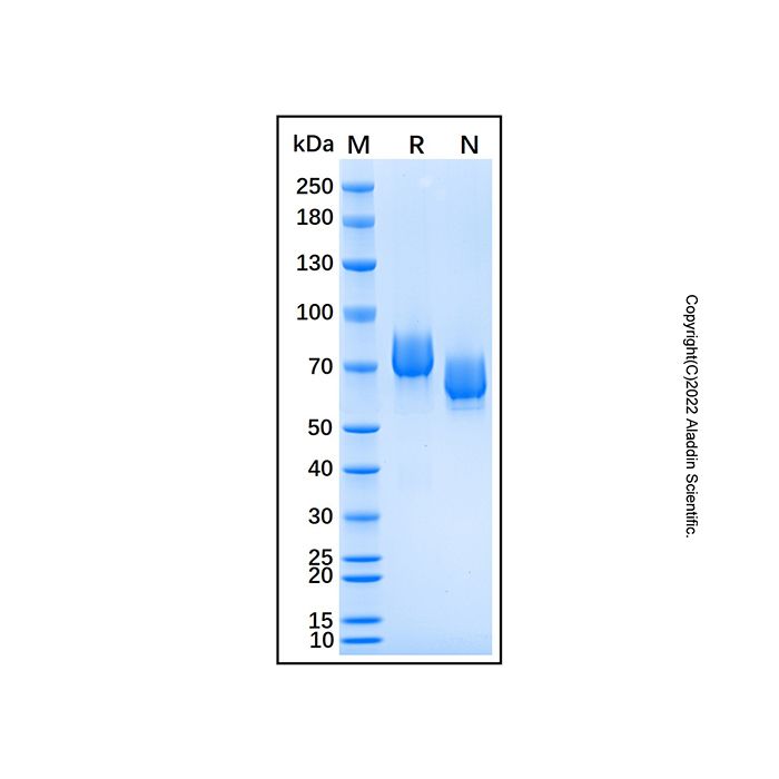 Recombinant Human EphA5 Protein -    by Aladdin Scientific