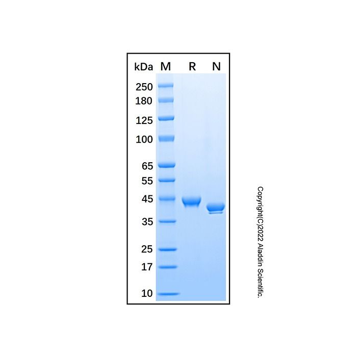 Recombinant Human Notum Protein -    by Aladdin Scientific