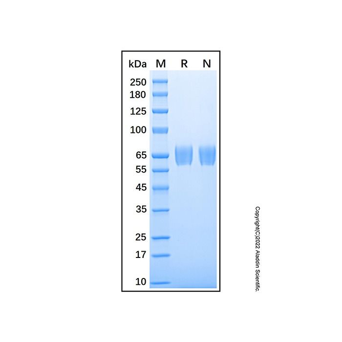 Recombinant Human Serpin F2/alpha 2-Antiplasmin Protein -    by Aladdin Scientific