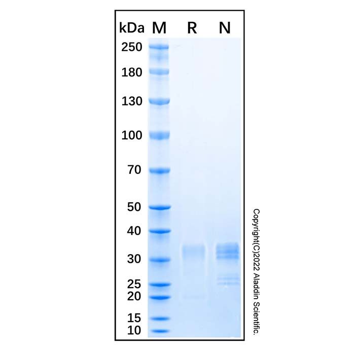 Recombinant Human Dkk-4 Protein -    by Aladdin Scientific