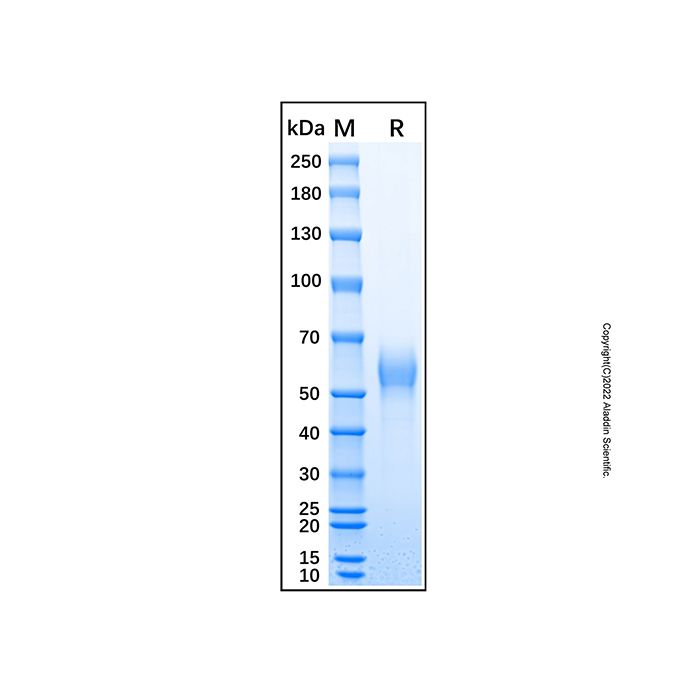 Recombinant Human CD161 Protein -    by Aladdin Scientific