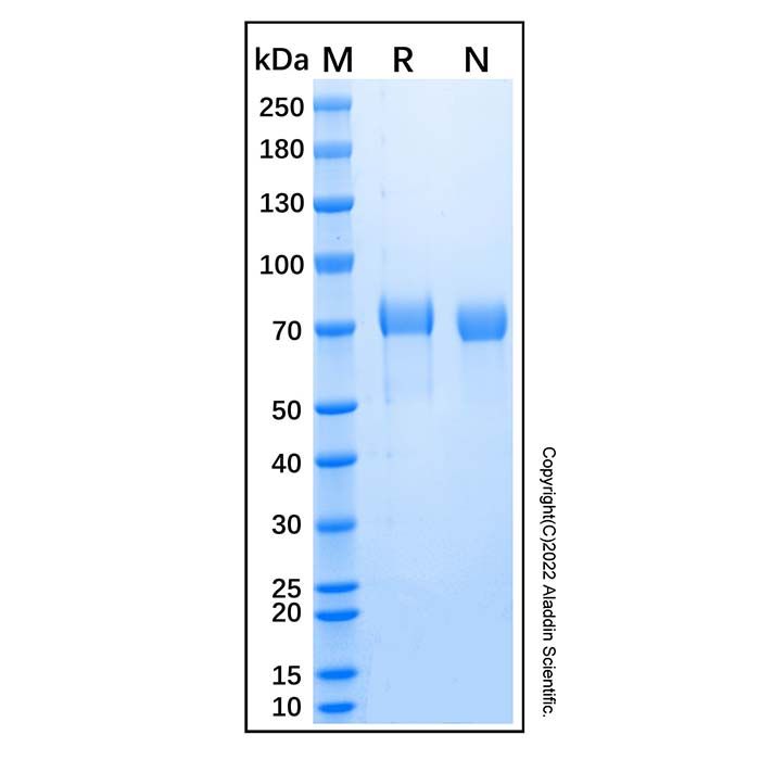 Recombinant Human SMPD1 Protein -    by Aladdin Scientific