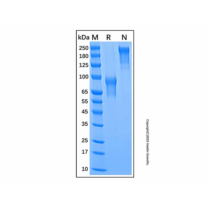 Recombinant Mouse IL-15R alpha Protein -    by Aladdin Scientific