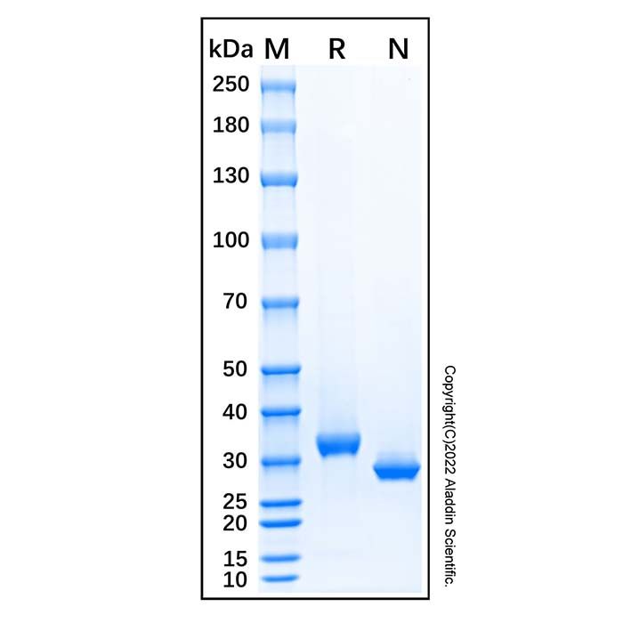 Recombinant Human sFRP-2 Protein -    by Aladdin Scientific