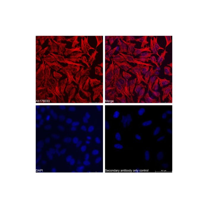 Recombinant Streptavidin Protein (TRITC) -    by Aladdin Scientific
