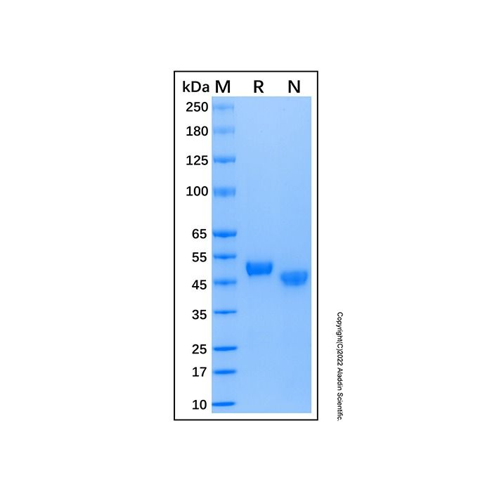 Recombinant Human RAGE Protein -    by Aladdin Scientific