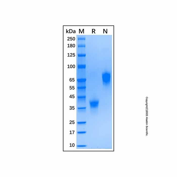 Recombinant Human BCMA/TNFRSF17 Protein -    by Aladdin Scientific
