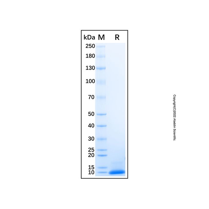 Recombinant Human Complement Component C5a Protein  -    rp169563 by Aladdin Scientific
